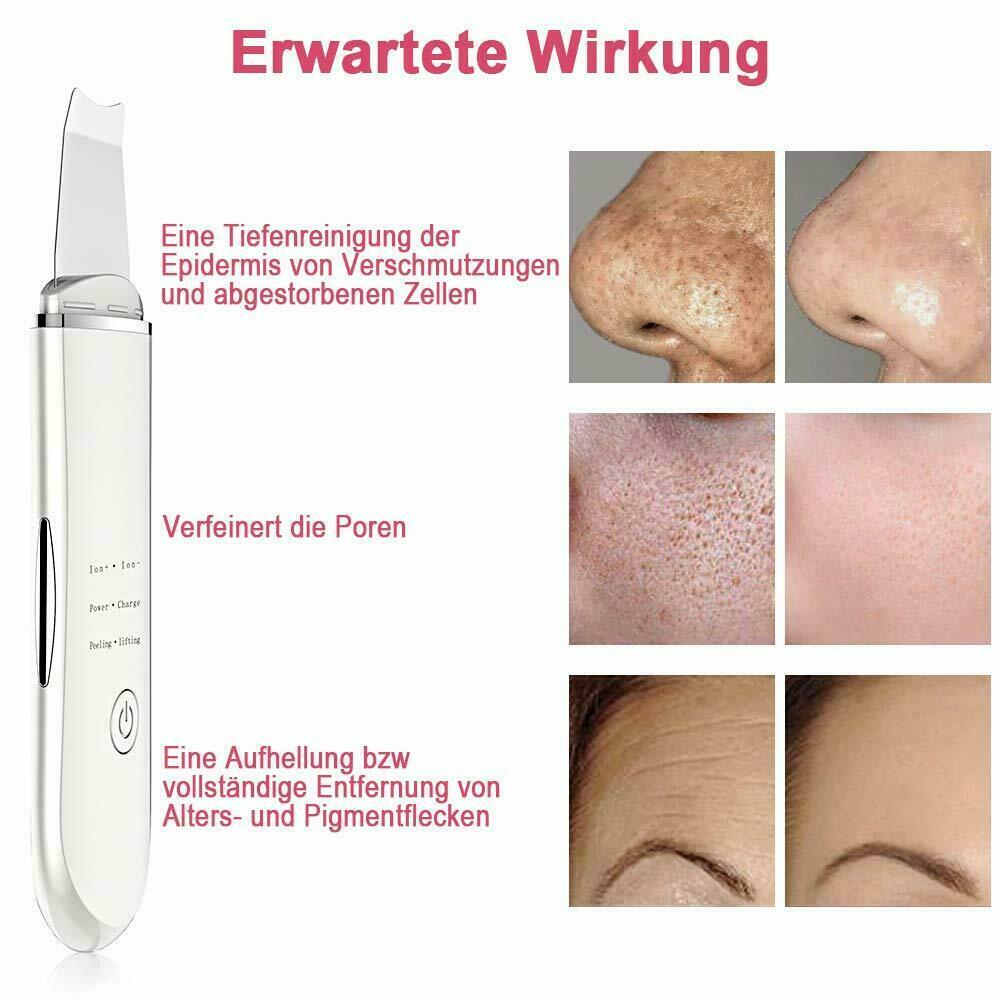 Bild 21 - Ultraschallgerät Reiniger Porenreiniger Gesicht Mitesserentferner Skin Scrubber