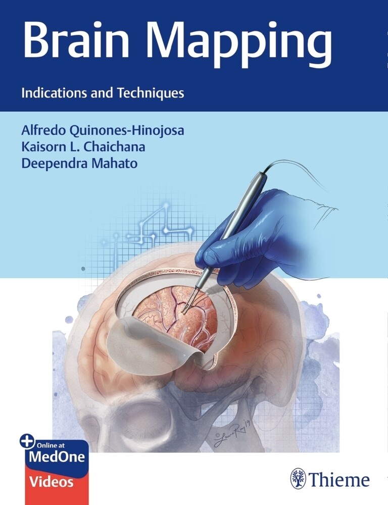 Thumbnail - Brain Mapping | Alfredo Quinones-hinojosa (u. A.) | Bundle | Englisch