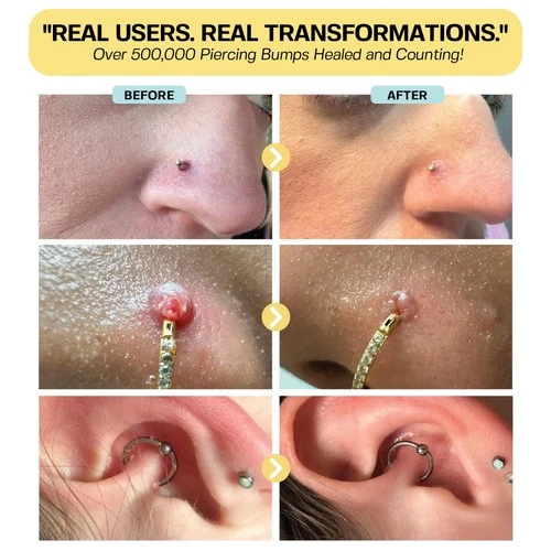 Piercing Bump Solution Oil for Keloid Bump Removal 0.5 oz ~ BASE LABORATORIES image 4