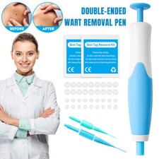 Micro Skin Tag Remover Tool Kit Rubber Bands for Wart Acne Skin Tags Removal US