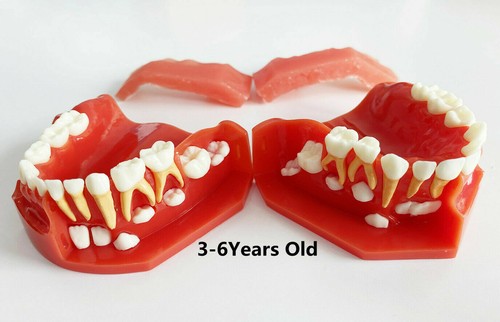 Dental Pediatrics Teeth Model Children 3-12 Year Old Permanent Alternate Model - Picture 9 of 12