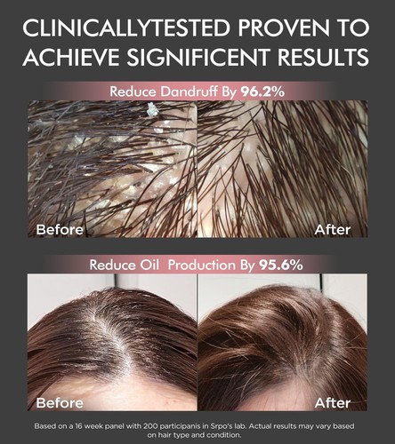 Juego de champú y acondicionador de biotina para el crecimiento del cabello con infusión de tripéptidos, anti cebolla... - Imagen 5 de 6
