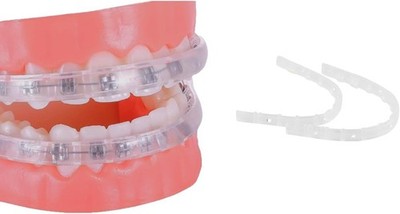 Lippenschutz für Zahnspangen Kieferorthopädischer Mundschutz für Zahnspangen Wachs Alternative
