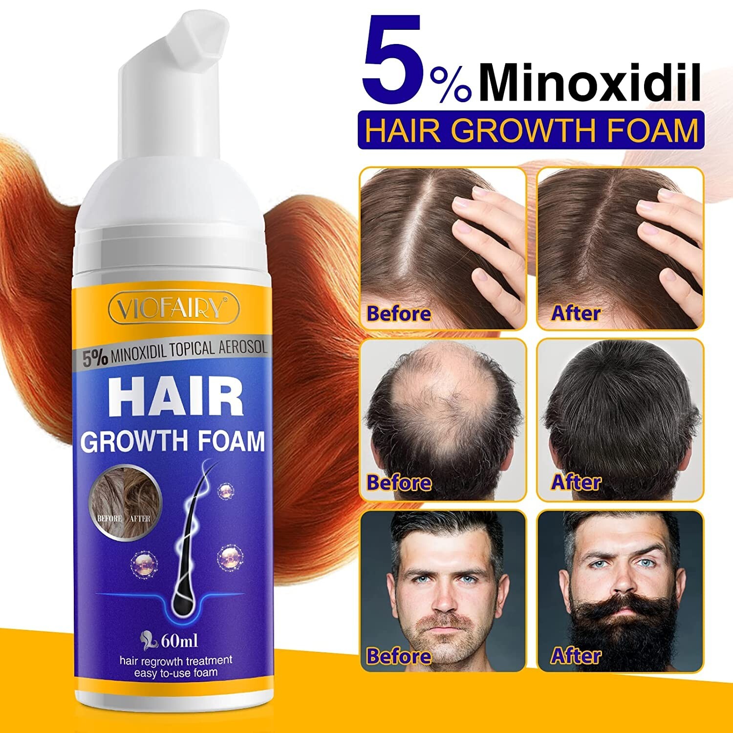 Viofairy Hair Growth Treatment Hair Growth Foam 60ml EXP 2/25/26 NEW