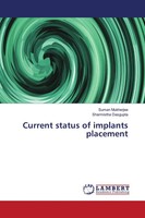 Suman Mukherjee (U. A.) | Current Status Of Implants Placement | Taschenbuch