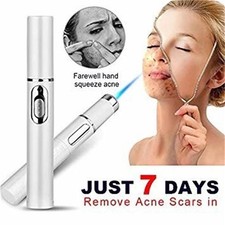 Blue Light Therapy Acne Laser Pen Soft Scar Wrinkle Removal Treatment Device Ski