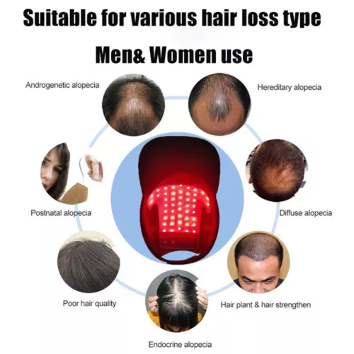 Hair Loss LED Red and Blue Near Infrared Light Therapy Cap Hat for Hair Regrowth - Picture 11 of 12