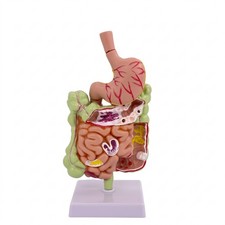 Large Intestine Model with Stomach Anatomical for Doctor Office, Doctors