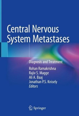 Central Nervous System Metastases: Diagnosis and Treatment by Rohan Ramakrishna 