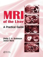 Mri Of The Liver A Practical Guide Philip J. A. Robinson (U. A.) Taschenbuch