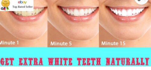4 bandejas bucales blanqueadoras dentales escudos moldes de goma remodelables - Imagen 2 de 7