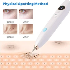 Laser Plasma Pen Anti-Aging Skin Wart Tag Tattoo Mole Removal Dark Spot Remover