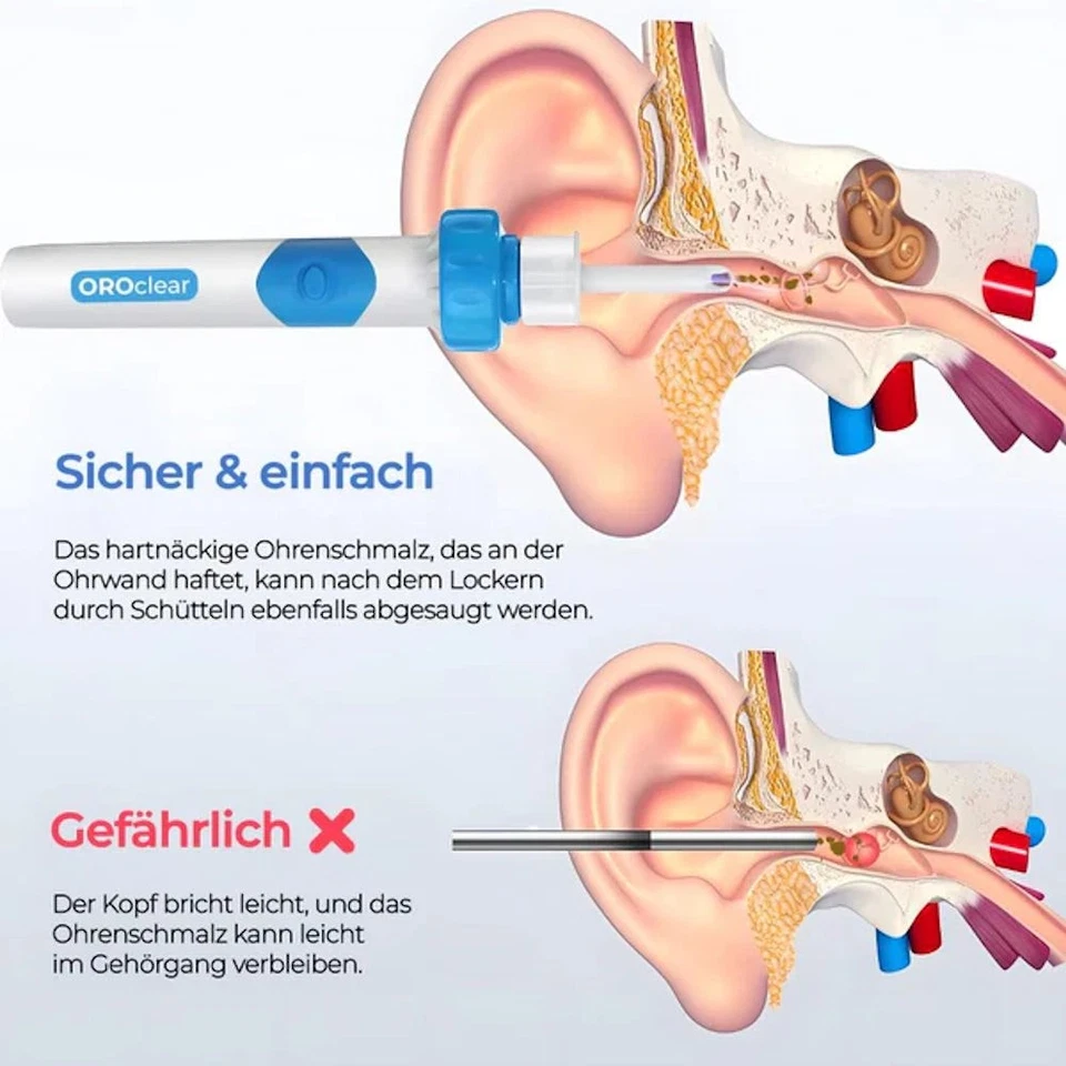 OROclear™ Limpiador de oídos eléctrico Eliminador de cera de oído Limpiador de cera de oído - Imagen 3 de 4
