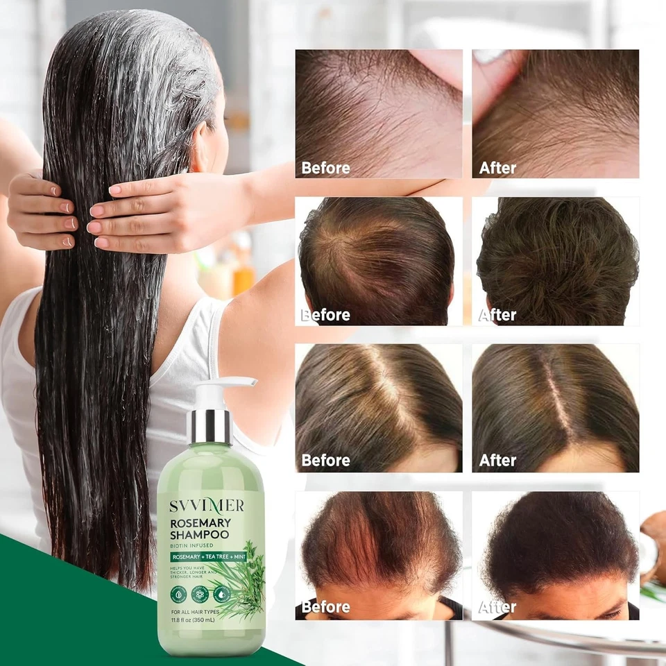 Rosemary Hair Growth Shampoo: Thickening and Regrowth Formula for Men & Women... - Image 2 of 4