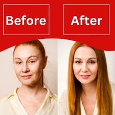 Skin Lightening Cream Extra Strength Lighter FAST Result-NO SIDE EFFECTS, 30gm