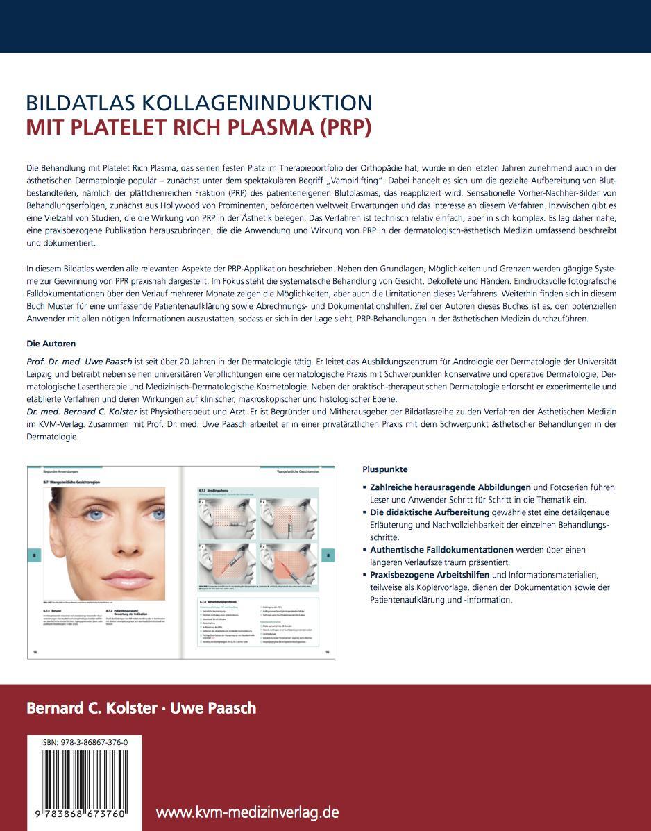 Thumbnail - Bildatlas Kollageninduktion Mit Platelet Rich Plasma (prp) Uwe Paasch