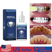 Dental Cavity Healing Tooth Armor Teeth Care Whitening Enamel Restoration 60ml 