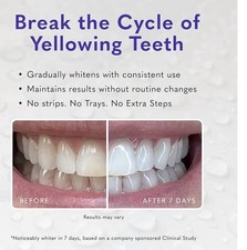 smileactives Pro Whitening Gel Teeth Whitenin...