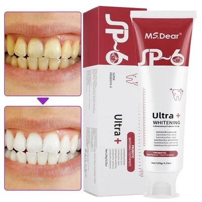 MS.DEAR SP-6 Probiotic Toothpaste,SP-6 Toothpaste Ultra Whitening Quick Fresh Breath UK