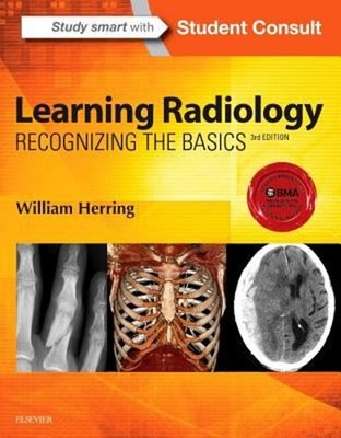 Learning Radiology : Recognizing the Basics Paperback William Her