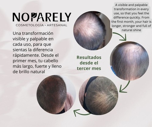 Noparely Artisanal, Nopal Hair Shampoo with Herbal Extracts. Hair Growth shampoo - Picture 4 of 4