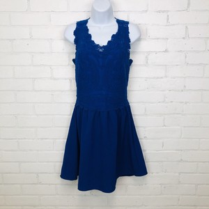 h and m blue lace dress