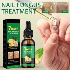 Traitement Des Champignons Ongles D'Orteils Dispositif De Réparation Des Ongles