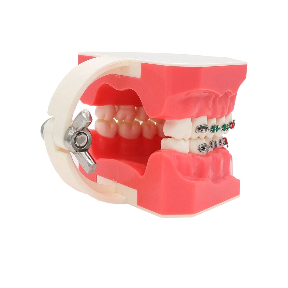 1:1 Dental Teach Study Typodont Teeth Model With Metal Ceramic Brackets ...