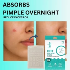 BAKE Waterproof  72 Patches Dots use for  For Acne , Acne Marks, Acne Prone Skin