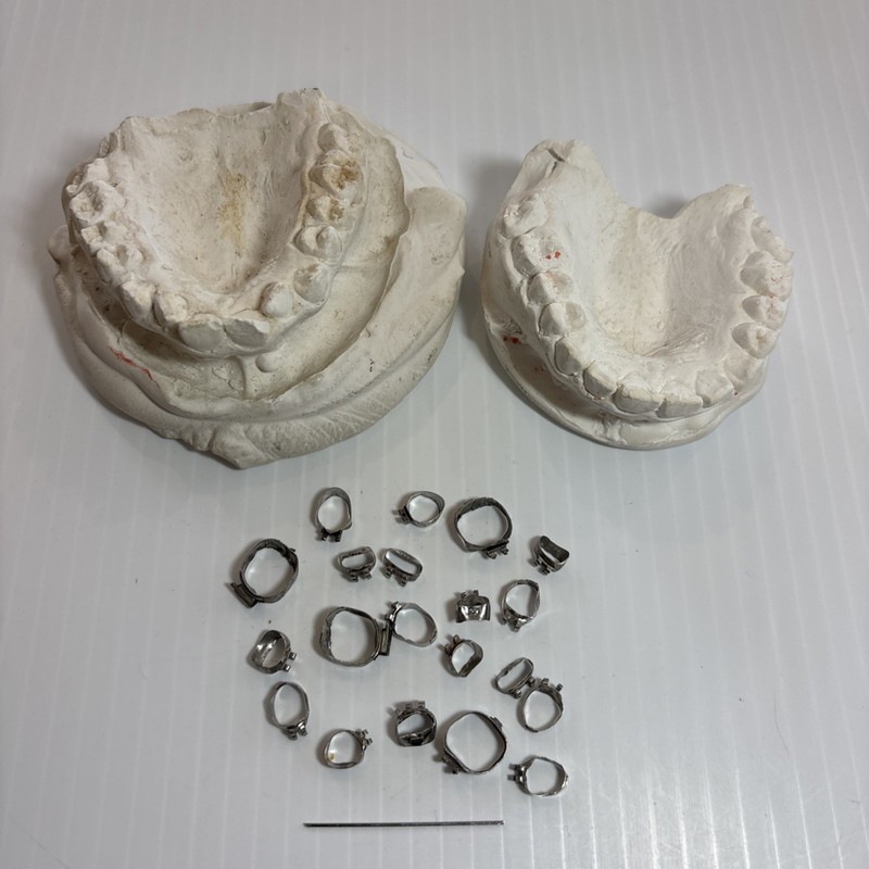 Set of 2 Vintage Plaster Cast Dental Molds Metal Braces Before & After Casts ‘79