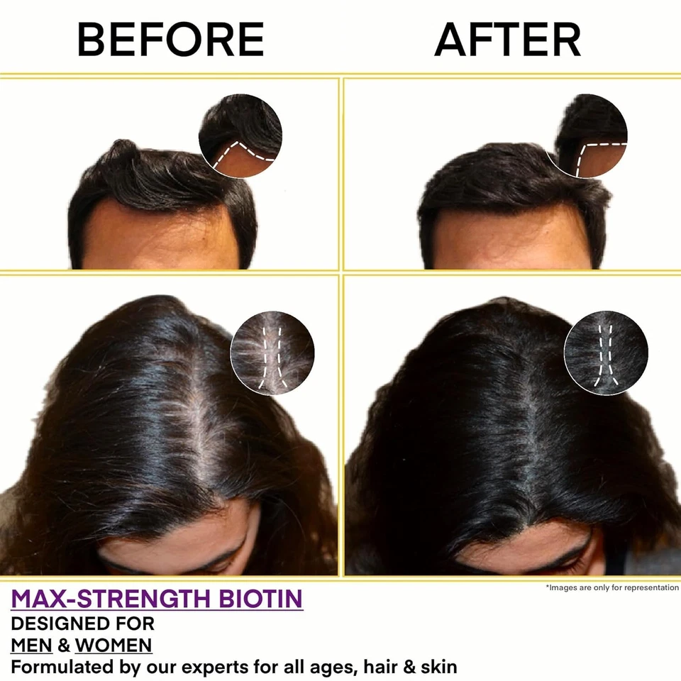 Vitamina B7 Biotina 10000mcg 120 Comprimidos Vegetales, Crecimiento del Cabello, Suplemento Piel y Uñas Foto 4 de 4