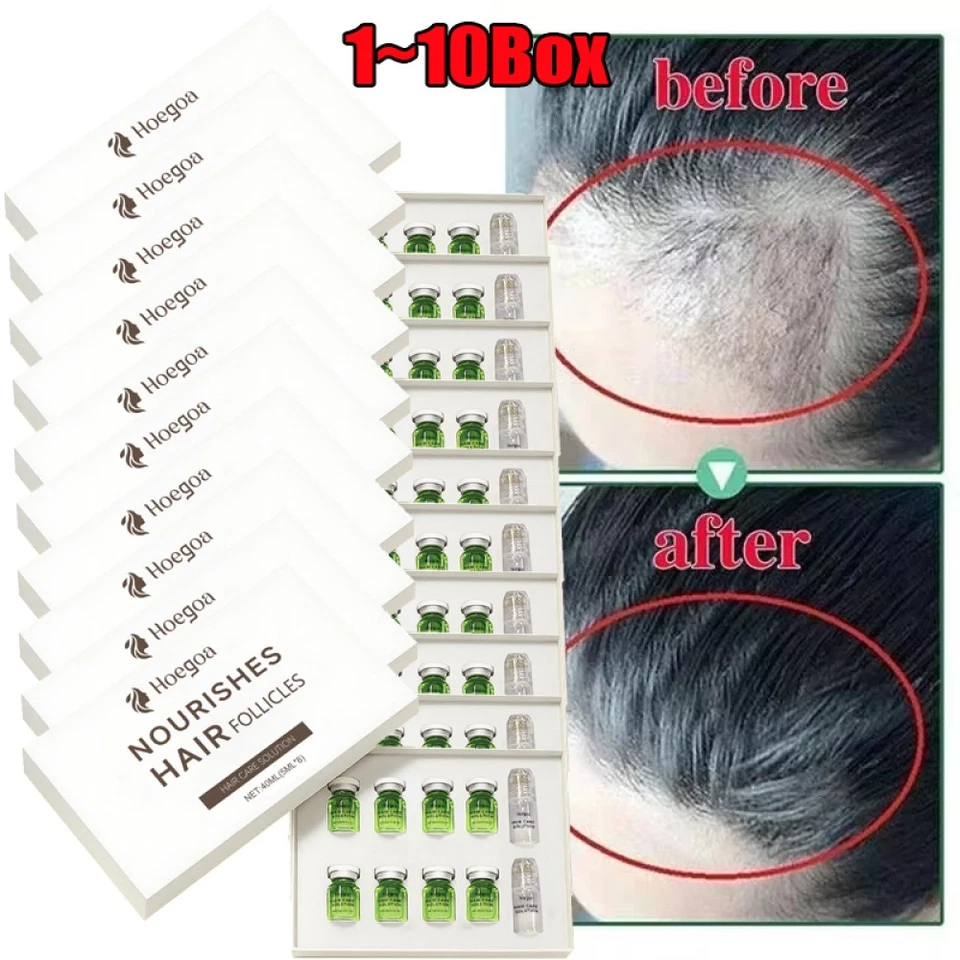 8Pcs/Set Microneedle Hair Regrowth System, Advanced Hair Treatment Ginseng Serum - Image 3 of 4