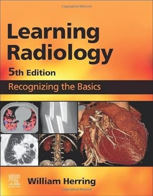 William Herring - Learning Radiology   Recognizing the Basics - Paperb - K245z