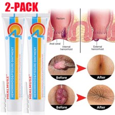 Hemorrhoids Remove Ointment Herbal Cream Relief Piles Pain Reduce Itching - 2Pcs