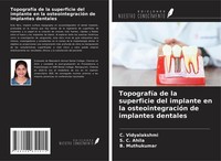 TopografíA De La Superficie Del Implante En La OsteointegracióN De Implantes Den