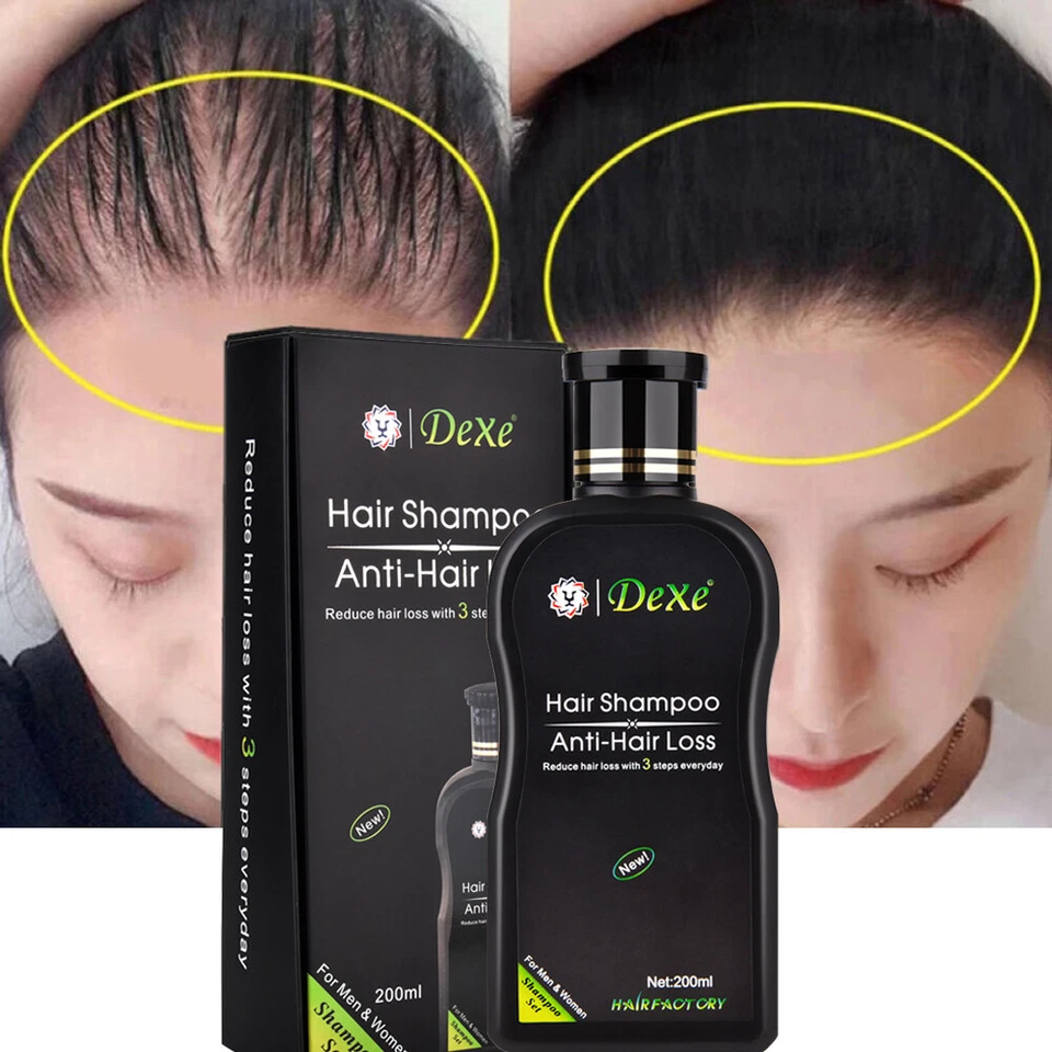 Hair Growth Shampoo Hair Regrowth Treatment Anti-Hair Loss Shampoo For Men Women - Image 2 of 4