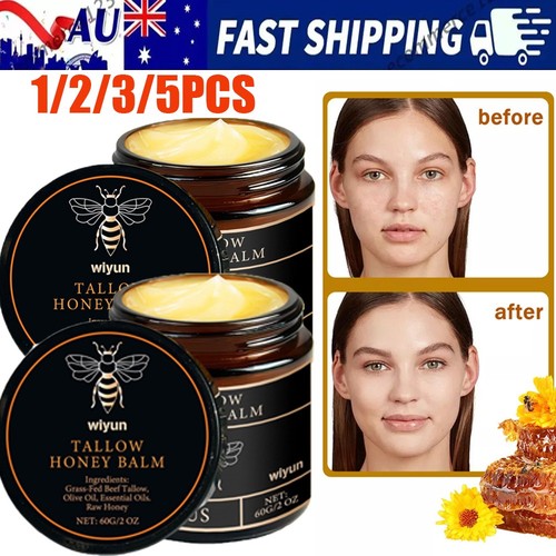 5x Organic Grass Fed Beef Tallow Moisturizing Cream Body Care Balm W/Raw Honey - Picture 1 of 17