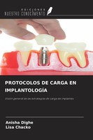 Anisha Dighe (U. A.) | Protocolos DE Carga EN ImplantologÍA | Taschenbuch (2025)