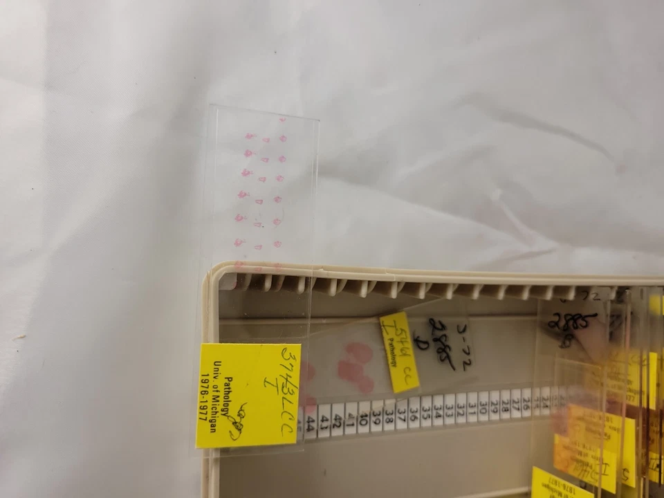1976-77 Pathology Neoplasm University of Michigan Microscope Slides - Image 3 of 4