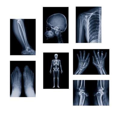 X-ray Science Education Package for Human Anatomy 8.3 inches by 11.7 