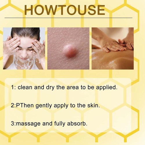 2Pcs Bee Venom Repair Creams, 2025 Professional Formula for Skin Treatment - Picture 6 of 11