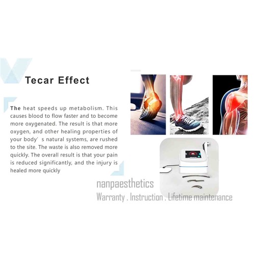 Máquina de terapia profesional inteligente Tecar RF fisioterapia masaje adelgazante corporal - Imagen 10 de 16