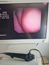 olympus CYF V video endoscope cystoscope visera v endoskop