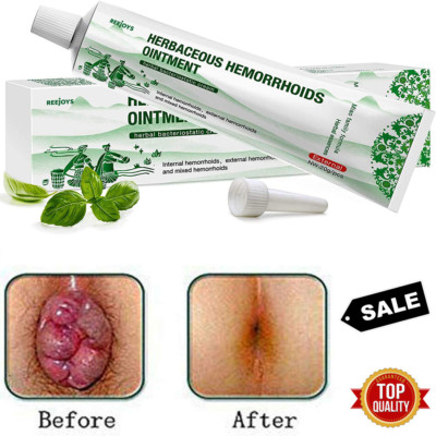 #1 Mejores Crema Para Las Hemorroides Tu Puedes Liberarte Del Dolor Y Sangrado