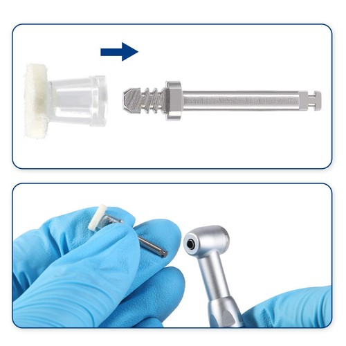 Kit de Discos de Pulido de Pasta de Composite Dental 50Pcs Discos Desechables - 第 8/20 張圖片