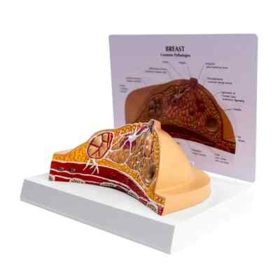 Artificial Human Pathological Female Breast Model - Cancer Anatomical Models New