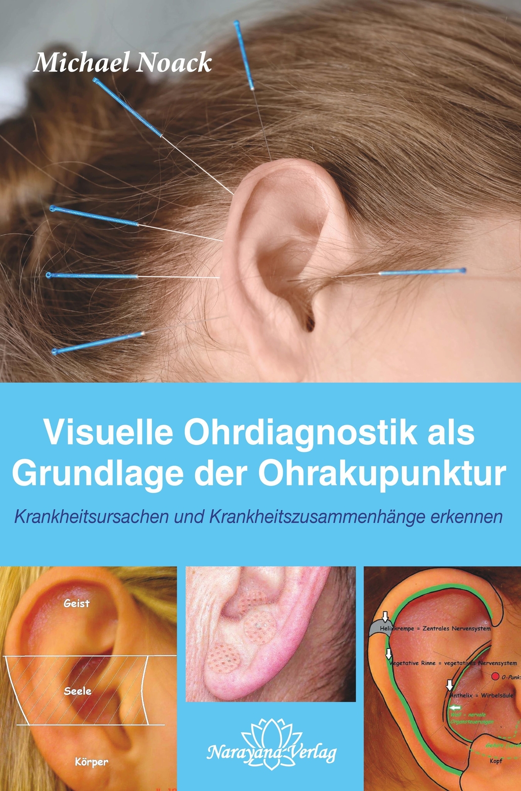 Visuelle Ohrdiagnostik Als Grundlage Der Ohrakupunktur | Michael Noack