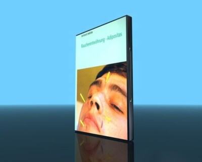 Raucherentwöhnung   Adipositas Ganzheitliche Suchttherapie mit Akupunktur - DVD
