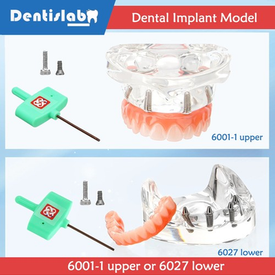 #ad Dental Implant Model Simulator All on 4 Overdenture Treatment Model Upper Lower $119.99