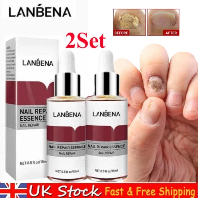 2X LANBENA Fungal Nail Repair Essence Serum + Nail File Hand & Foot Treatment